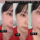 탄력케어 기초템 추천 더마팩토리 PDRN 에센스크림