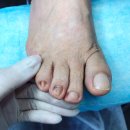 레푸스 앤 쓰담네일 이미지