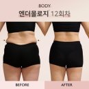 매일엘피지 이미지