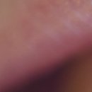보광치과의원 네이버블로그