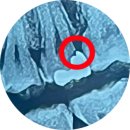 [리뷰/후기]내가 가본 치과 내돈내산 양심치과/과잉진료/오진치과/ 대충진료 /전남/인천/강서구/서울...
