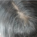 주식회사 세븐메디컬 | 탈모샴푸 에이치세븐 덜빠지네!