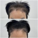 이소브로우 | [인천눈썹 인천아이라인] 부평 비비브로우 – 9년 차 원장의 1:1 디자인 시술 후기