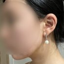 청담청초 내돈내산 모음 후기- 포도송이 이중턱 지방흡입