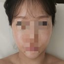 1564 | 청주웨딩관리 추천 청주강서동에스테틱 이래서 에스테틱 윤곽관리 솔직후기