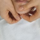 궁전피부관리