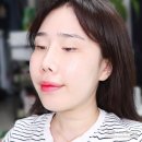 텐 프로 | 시청역피부과 텐써마 리프팅 내돈내산 후기 (전후/통증/효과)