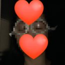 예본안과의원 | [라섹 후기] 종로 예본안과 :: 내돈내산 눈물의 라섹 후기