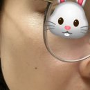 라움성형외과의원 루비레이저 1년 후기! 잡티·주근깨 고민 끝났을까? (솔직 변화 과정)