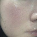 이온샘 | 연산동 모공관리 리제이에스테틱 세멘부스팅먼트후기