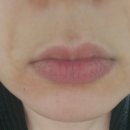 이삭토스트 정관점 | 정관피부관리 올가드림정관모전점