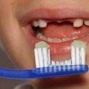 수플란트 이미지