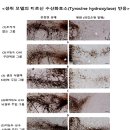 항산화제 뇌 직접 투여하니… 파킨슨병 치료효과 ‘극대화’ 이미지