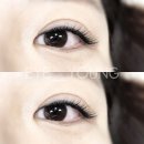 EYE이뻐 이미지