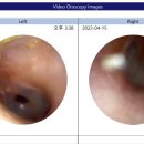효자보청기 이미지