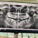 예플란트치과의원 이미지