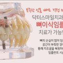 닥터스마일치과의원 네이버블로그