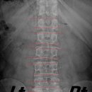 Re:x-ray 리스팅 질문입니다. 이미지