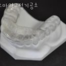 스마일교정치과기공소 이미지