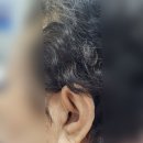 목동독일보청기 | 목동보청기 친절한 다비치히어링에서 보청기 진행한 후기!