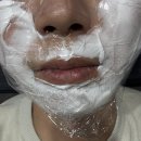 영등에너지 | 남자 가성비 피부과시술 하관 레이저 제모 1년 후기 (영등포 피부과 추천)