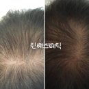 에센스에스테틱
