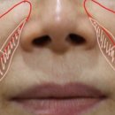 강남라렌의원 이미지