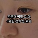 벨포인트의원 네이버블로그