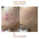 시크릿에스떼 네이버블로그