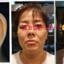 이혈(귀) 상담과 건강관리 이미지