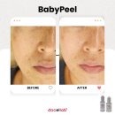 메딕프로코리아 | 닥랩 미백필 시그니처 "베이비필링" 인기체감