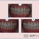 동의치과기공소 이미지