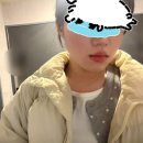 데일리의원 | [바이슈의원] 강남 신논현 피부과 | 심부볼컷주사...주사 | 내돈내산 윤곽주사 효과, 후기, 전후비교 사진