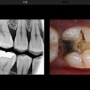 혼치과기공소 이미지