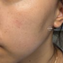 다다소라 x 코페르 포에버 라인 런칭 / 피부 진정, 수분, 모공, 기미, 잡티 케어 공구 후기