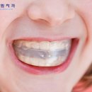 연세필치과교정과 이미지