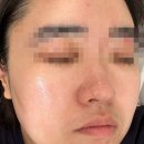 원뷰티스킨케어홍성 | [충남 홍성]내포피부샵 원뷰티 스킨케어 방문후기