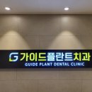 가이드치과의원 | # 원종동 가이드 플라트 치과 의원 _ 스케일링, 충치, 레진 및 크라운 진료 및 치료 필요성 후기 일지 기록