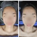 문래동피부관리 은&#39;s스킨&amp;바디 윤곽후기