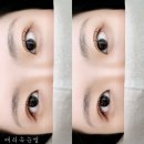 애리속눈썹