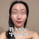 목동피부관리 셀럽메디스파 메디컬스킨케어 물광피부 물방울리프팅 신부관리
