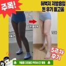 후차이 - 사하구 장림번영로 8-1 | [성형] 전주 허벅지 지방흡입 7주차 후기(후관리, 같은 몸무게 지흡 차이 비교)