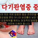 소양증 원인과 치료 및 후기 - 사암오행침, 사암침법, 오행침, 정통사암침 이미지