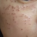 정영철피부과의원 이미지