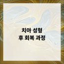 아이디마곡치과교정과치과의원 | 치아 성형 후 회복 과정