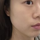 유아이 | 범어동에스테틱 웨딩관리 | "유아이에스테틱" 물광•하이푸 관리 후기