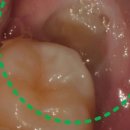 메디포레치과의원 이미지