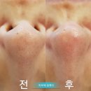 피부에설레다 | 군산 피부관리 피부에 설레다 이용한 후기