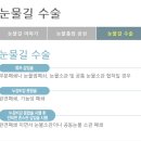 봄의약속안과의원 이미지