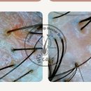 청정문경케어